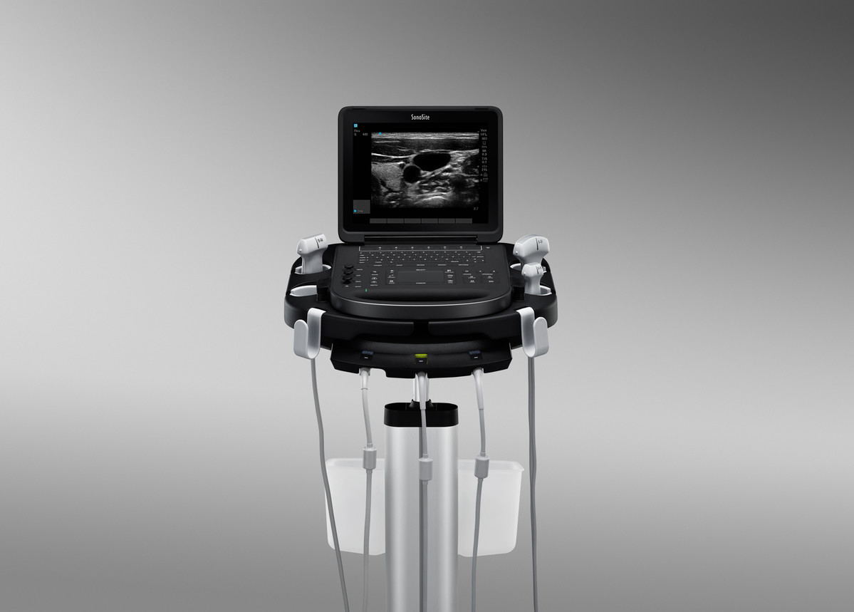 SONOSITE EDGE